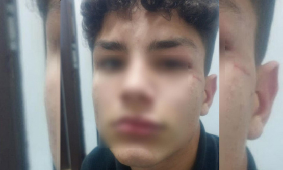 Violento ataque a un adolescente en pleno centro: buscan identificar al agresor