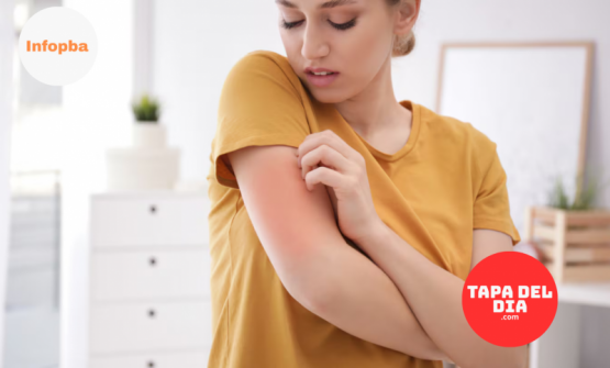 Campaña nacional gratuita busca detectar tempranamente la enfermedad psoriásica en Argentina