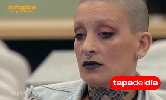 Furia Scaglione muestra su nueva nariz a tres meses de la cirugía: el cambio es impresionante