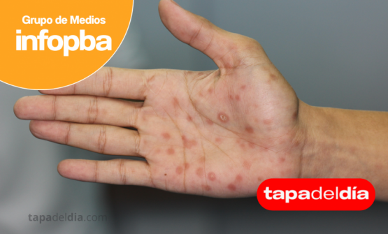 fuerte suba entre adolescentes y jóvenes encendió la alarma sanitaria